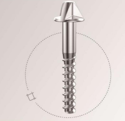 rail fastening rail fastening